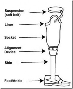 prosthesis.jpg111_thumb