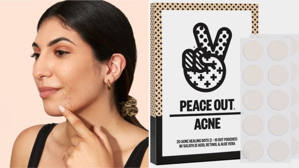 A woman with acne patches on her chin; a box of acne healing dots